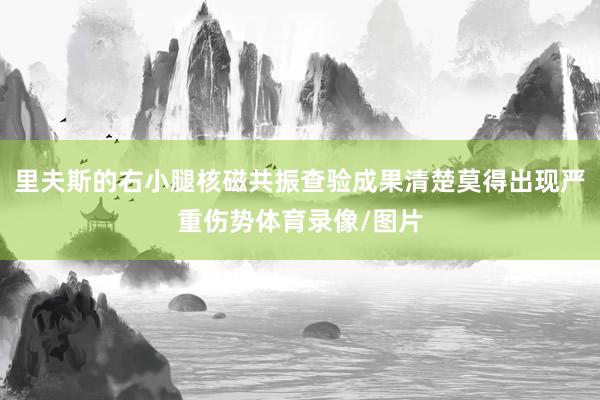 里夫斯的右小腿核磁共振查验成果清楚莫得出现严重伤势体育录像/图片